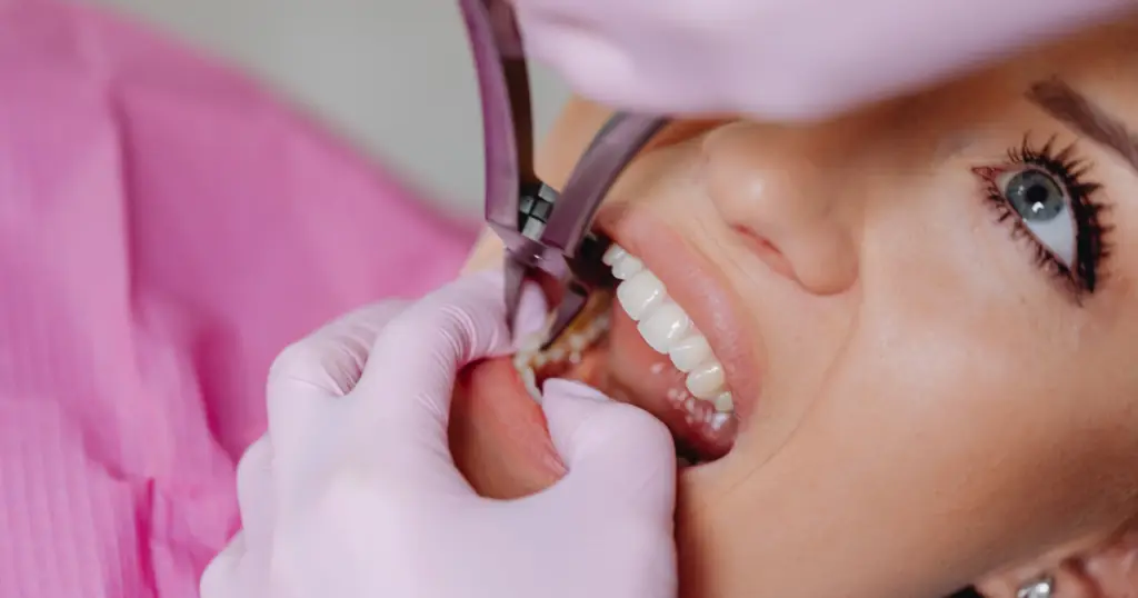 What dental care do you get free when pregnant