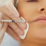 are dermal fillers covered by insurance
