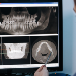 Will dental implants affect MRI