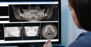 Will dental implants affect MRI