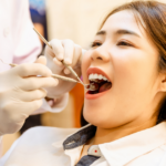 Can dental implants cause sinus problems